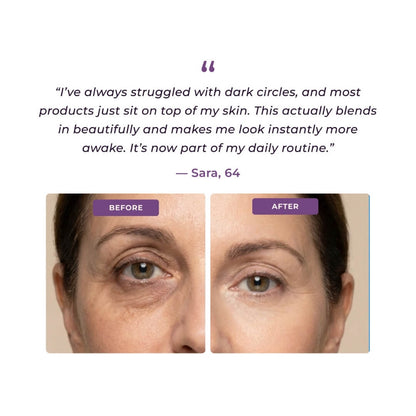 Cougex™Eye Concealer Undereye Brightener