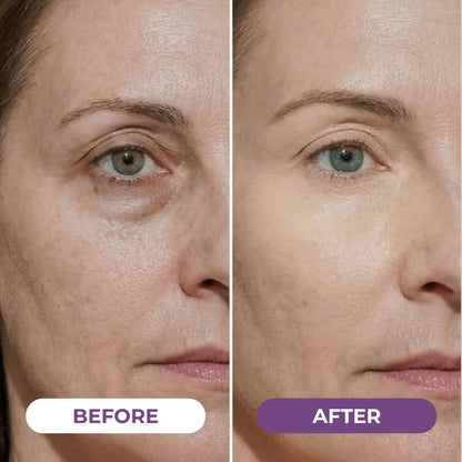 Cougex™Eye Concealer Undereye Brightener